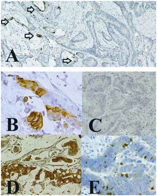 J Cancer Image