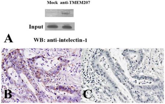 J Cancer Image