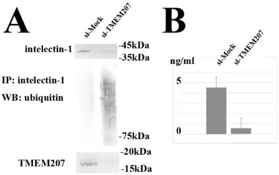 J Cancer Image