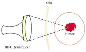 J Cancer Image