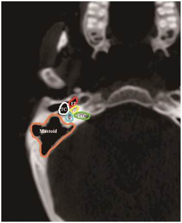 J Cancer Image