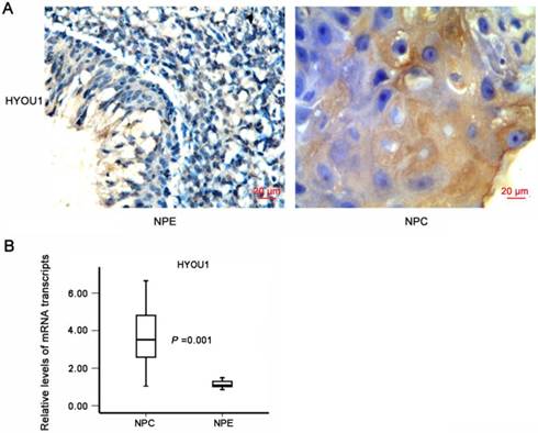 J Cancer Image