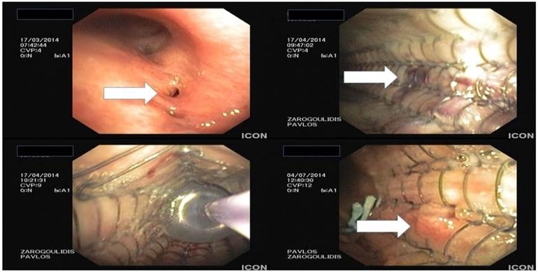 J Cancer Image