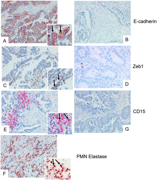 J Cancer Image