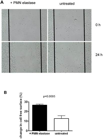 J Cancer Image