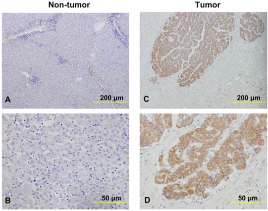 J Cancer Image