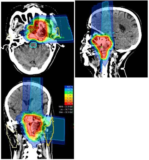 J Cancer Image