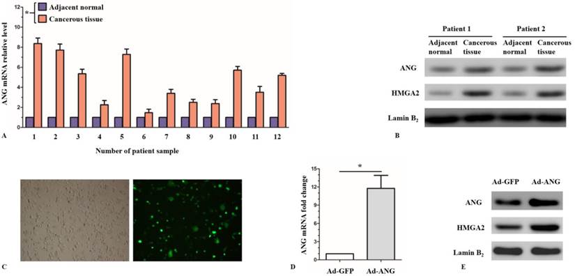 J Cancer Image