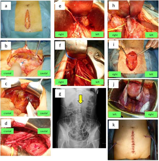 J Cancer Image