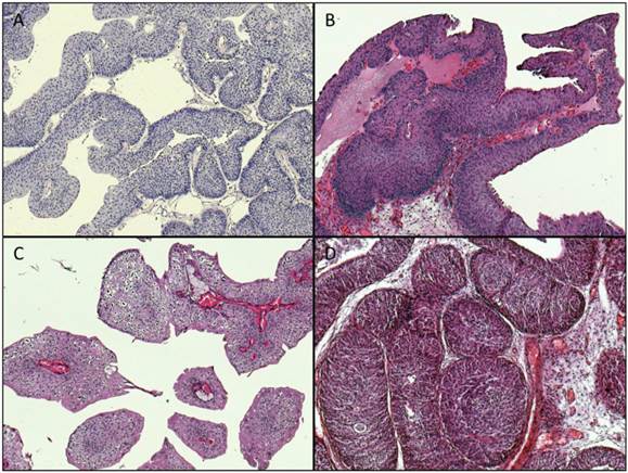 J Cancer Image