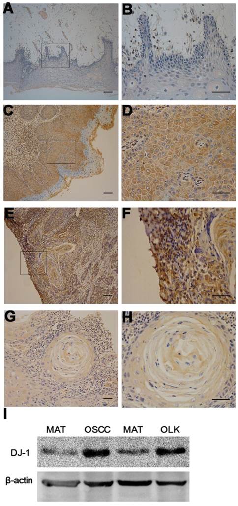 J Cancer Image