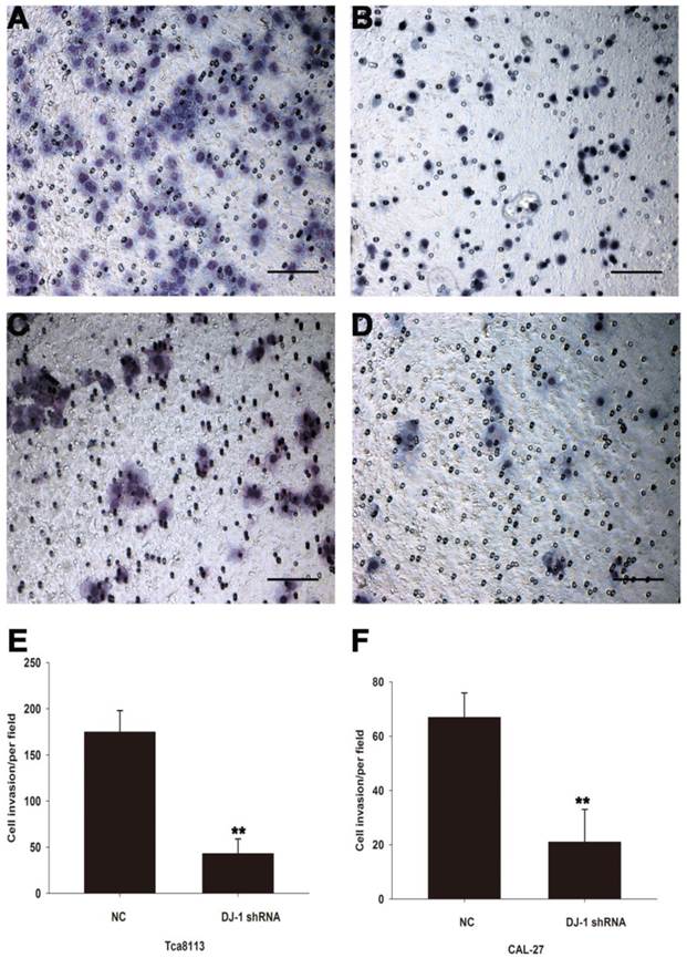 J Cancer Image