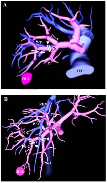 J Cancer Image