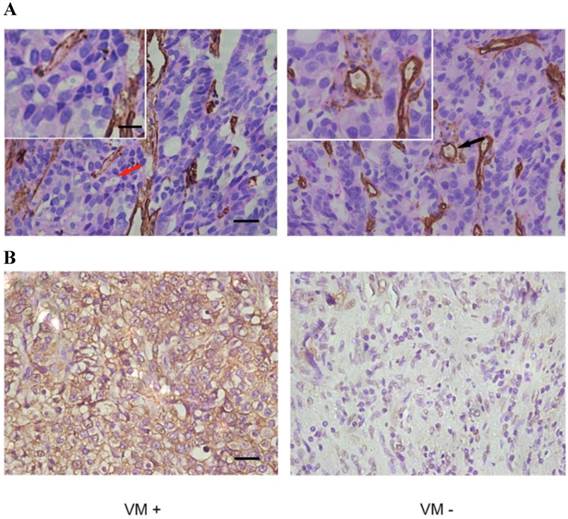 J Cancer Image