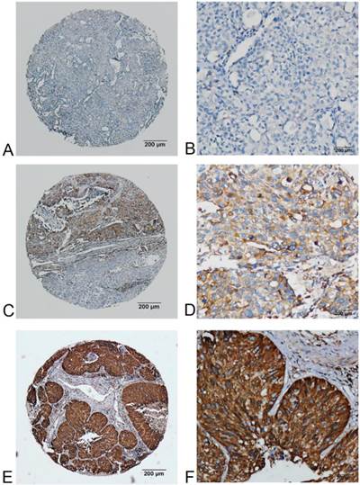 J Cancer Image