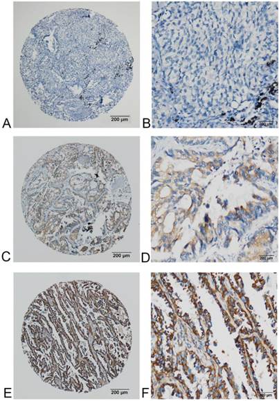 J Cancer Image