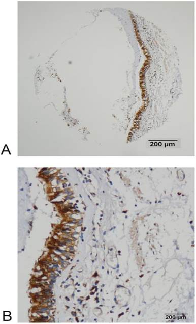 J Cancer Image