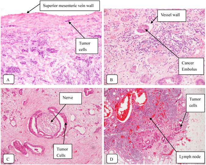 J Cancer Image