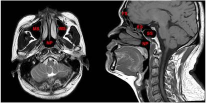 J Cancer Image