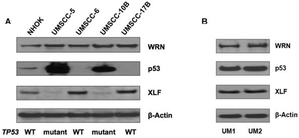 J Cancer Image