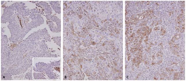 J Cancer Image