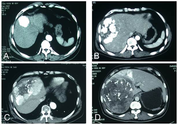 J Cancer Image