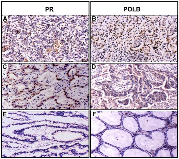 J Cancer Image