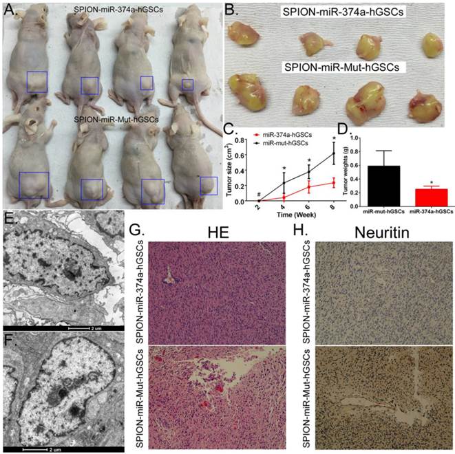 J Cancer Image