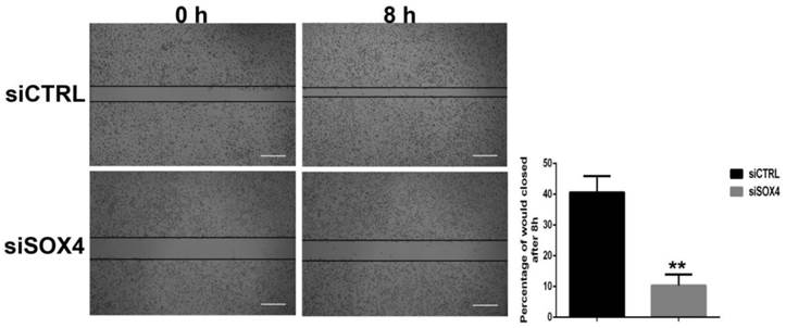 J Cancer Image