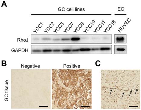 J Cancer Image