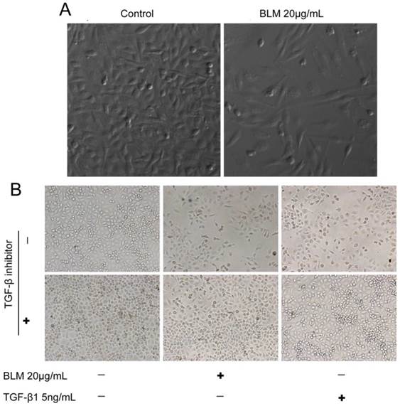 J Cancer Image