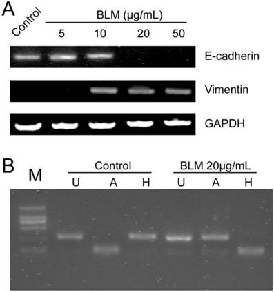 J Cancer Image