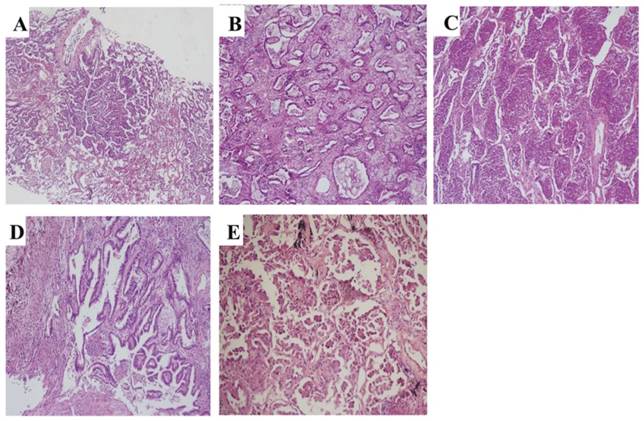 J Cancer Image