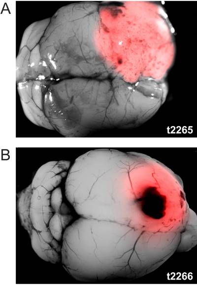 J Cancer Image