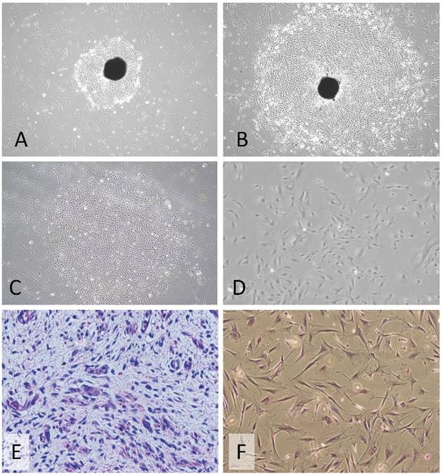 J Cancer Image