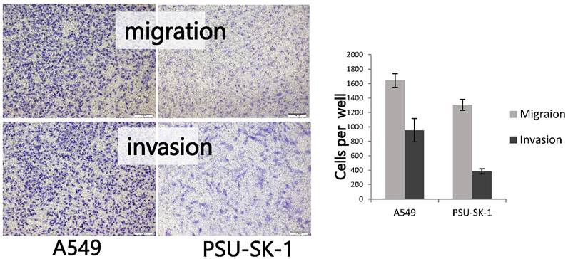 J Cancer Image