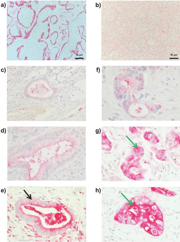 J Cancer Image