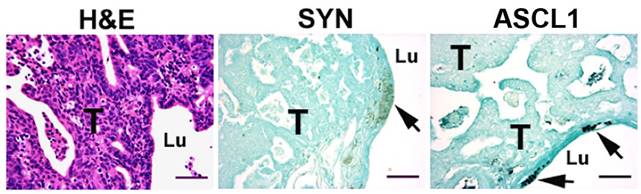 J Cancer Image