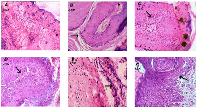 J Cancer Image