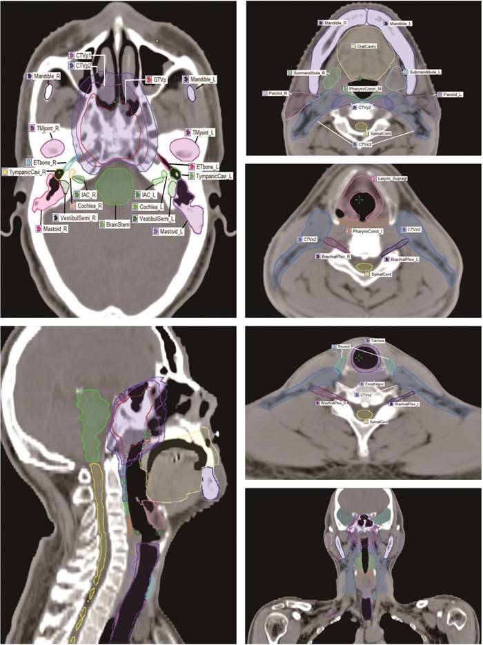 J Cancer Image