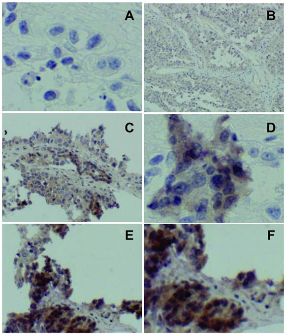 J Cancer Image