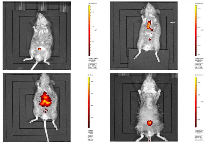 J Cancer Image