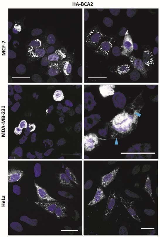 J Cancer Image