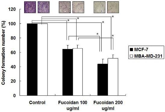 J Cancer Image