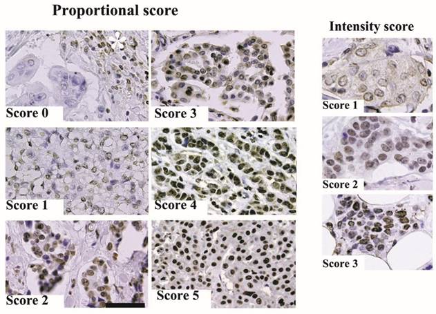 J Cancer Image