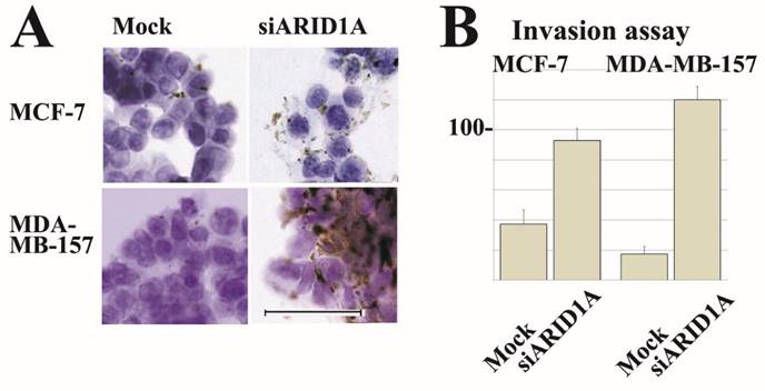 J Cancer Image