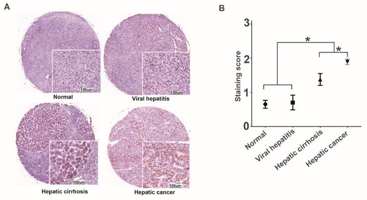 J Cancer Image