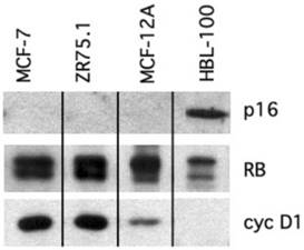 J Cancer Image