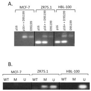 J Cancer Image