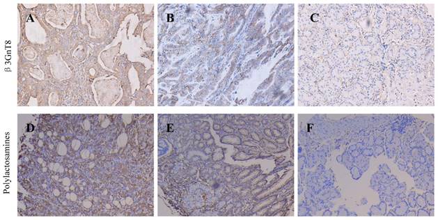 J Cancer Image